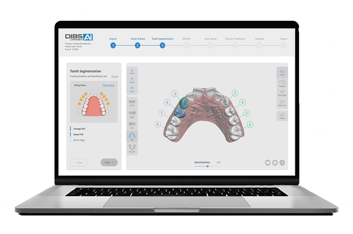 OrthoSelect Releases New DIBS AI Software